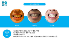 マウスピース369
